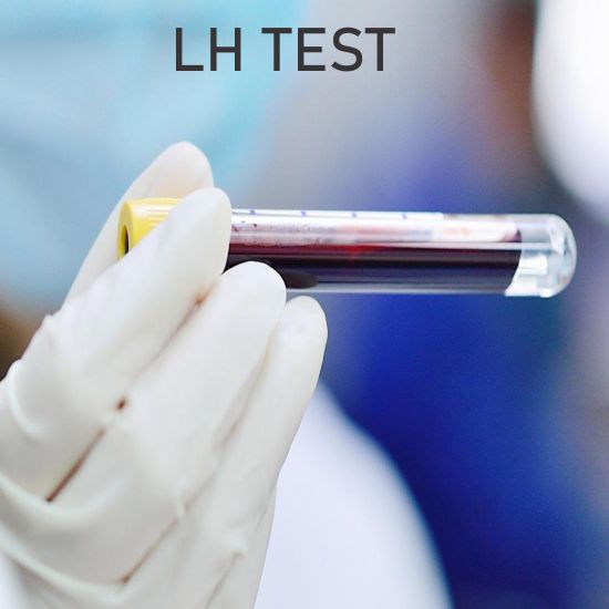 LUTEINISING HORMONE (LH) Test